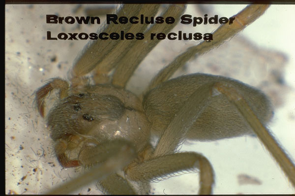 Chilean Recluse Spider